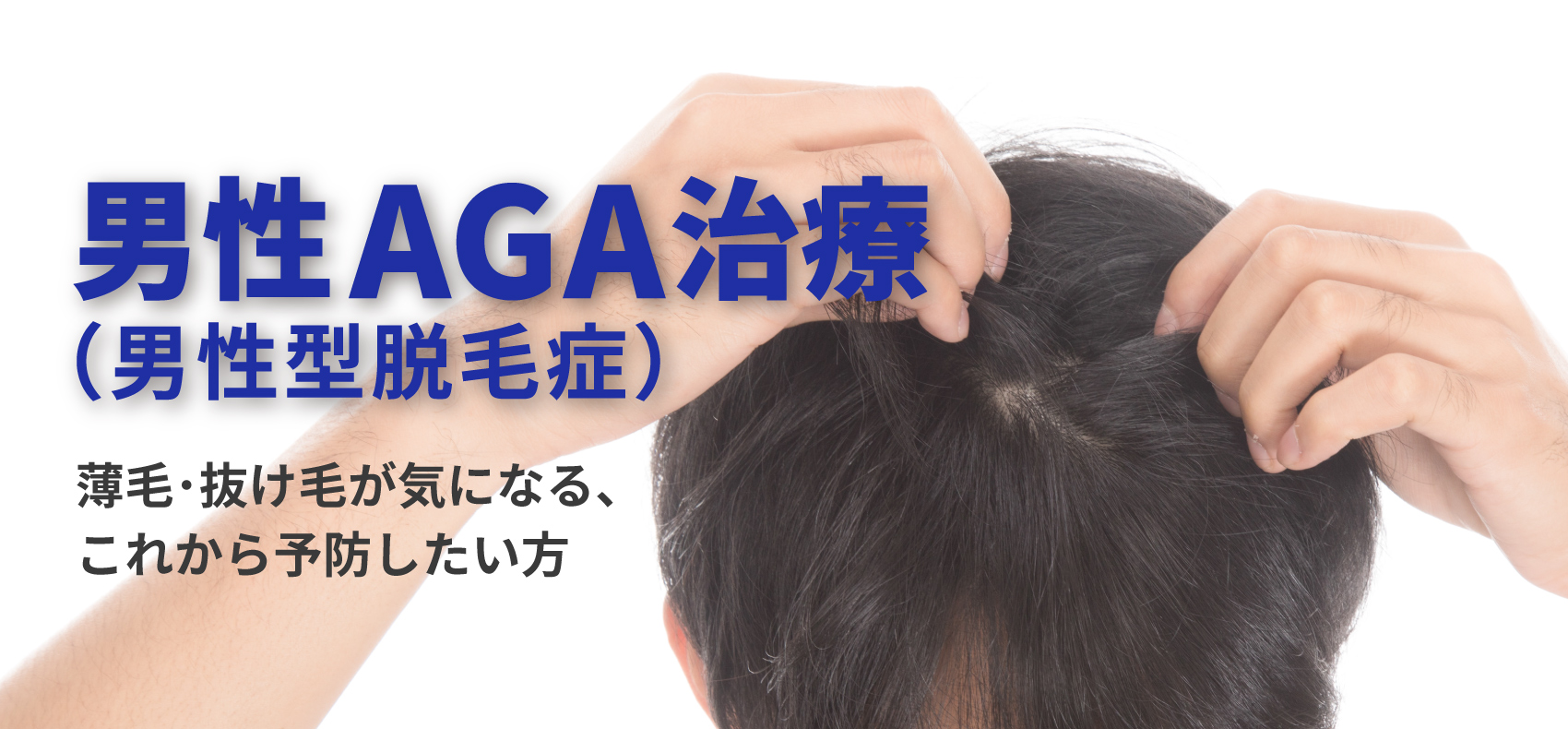 男性AGA（男性型脱毛症）治療